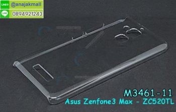 M3461-11 เคสแข็งใส Asus Zenfone3 Max ZC520TL